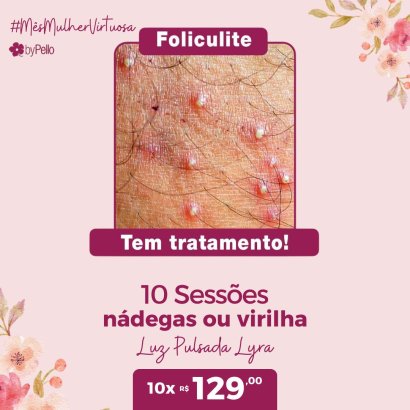 FOLICULITE-LUZ-PULSAD-BY-PELLO-MULHER